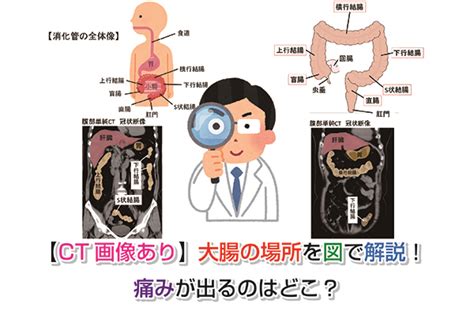 大腸 方向|【CT画像あり】大腸の場所を図で解説！痛みが。